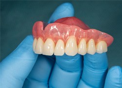 Gloved hand holding dentures in Syracuse, NY