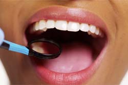 Closeup of patient getting fluoride treatment in Syracuse