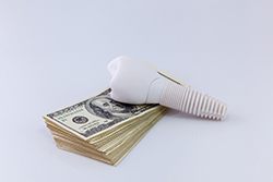 Model implant and money representing the cost of dental implants in Syracuse