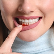 woman pulling lip down showing her gums