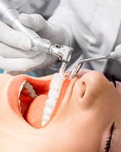 Woman receiving teeth cleaning