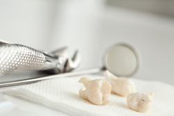 dent instruments with extracted molars 